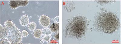 Stimulation of Osteogenic Differentiation of Induced Pluripotent Stem Cells (iPSCs) Using Bioactive Glasses: An in vitro Study